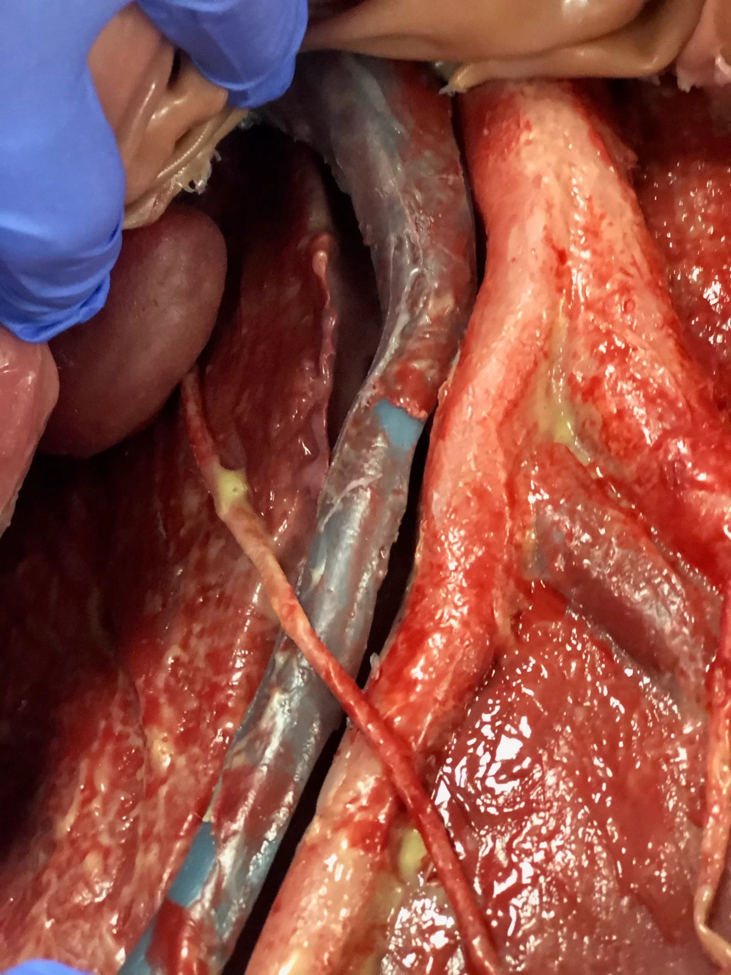 MSURG050 Abdominal Surgical Training Model Flexible image 6