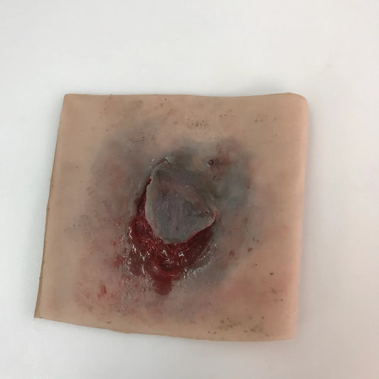MT022 Elderly Skin Tear image 1