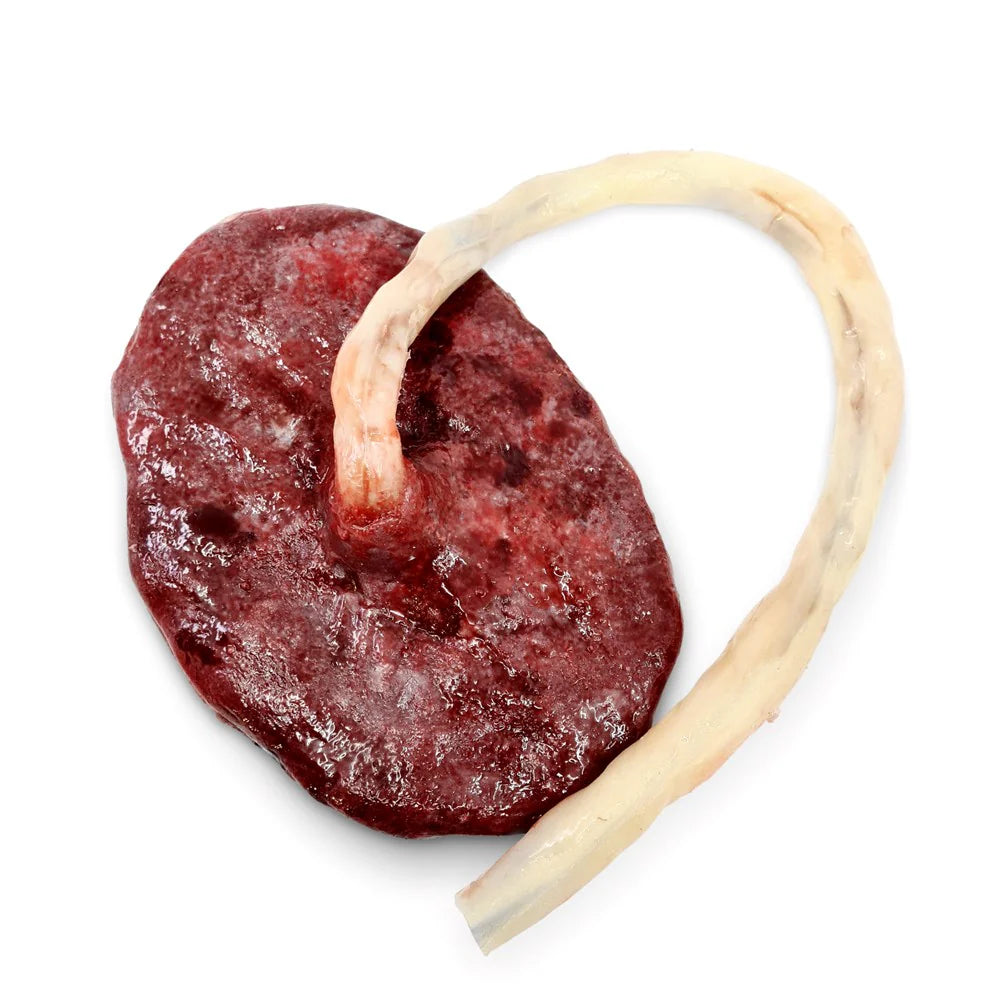 MO720 - Placenta & Umbilical Cord