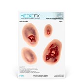 MP027 Sheet Small Fractures