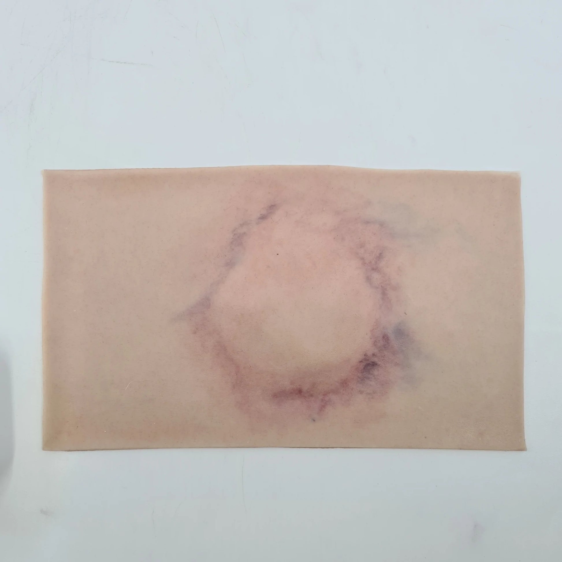 MT0031 Fracture Closed Small image 2