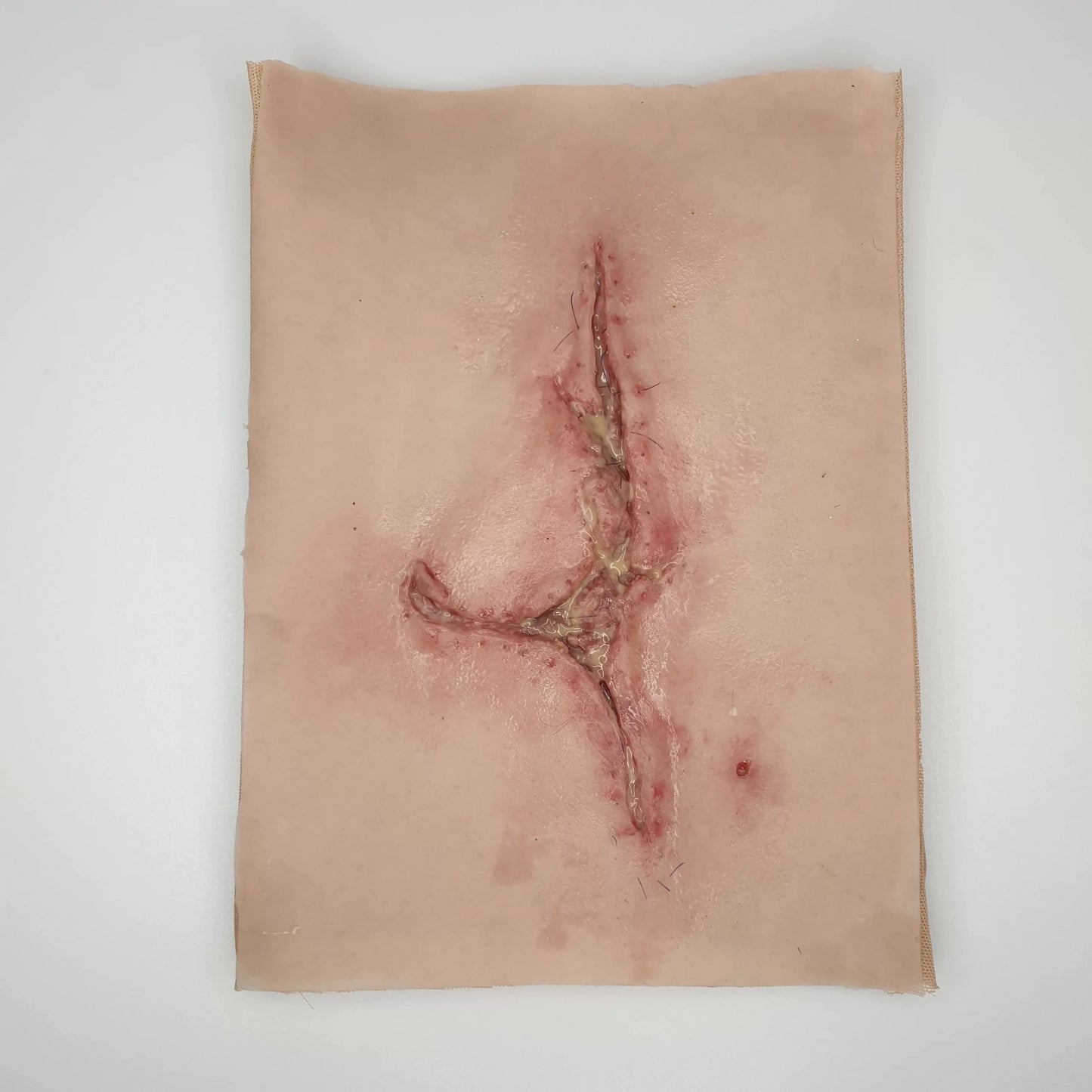 MW070 Large Infected Leg Wound image 0