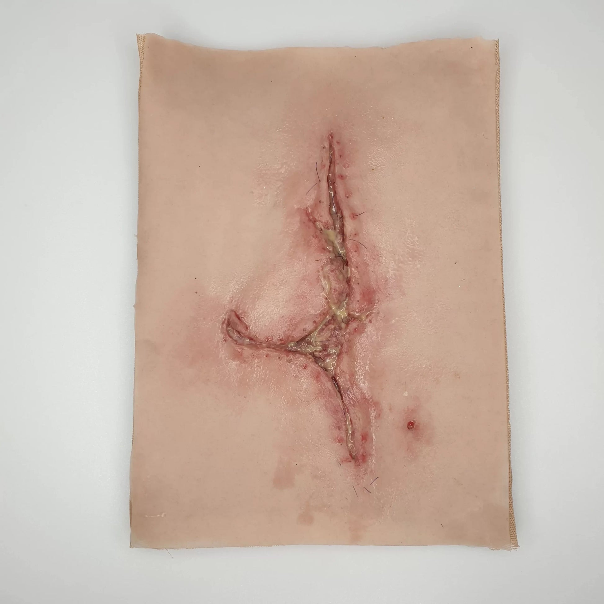 MW070 Large Infected Leg Wound image 0