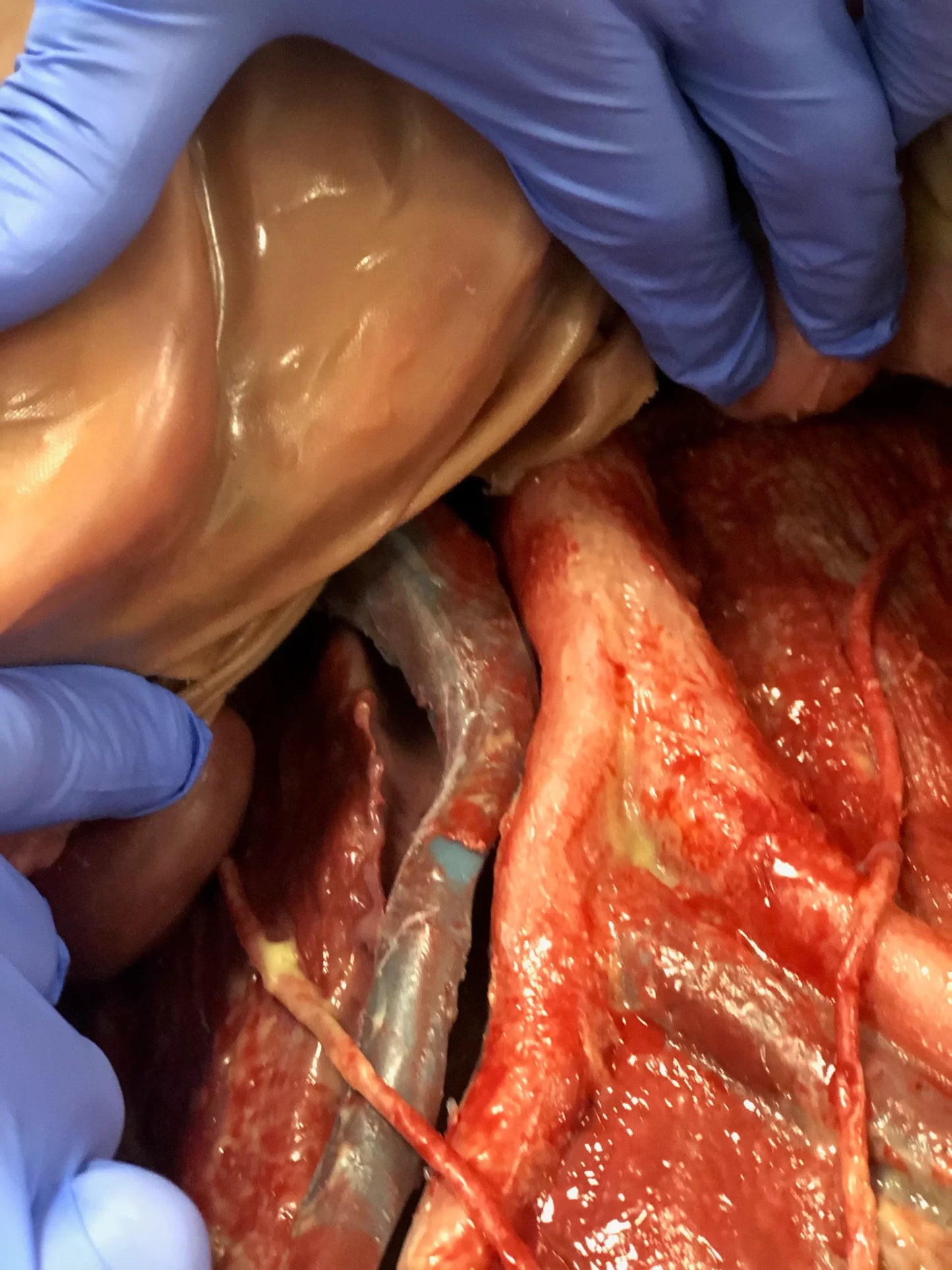 MSURG050 Abdominal Surgical Training Model Flexible image 5