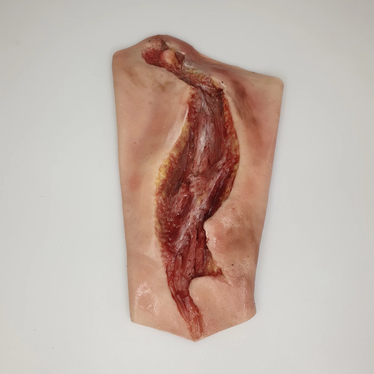 MB130 Electrical Burn Lower Arm image 2