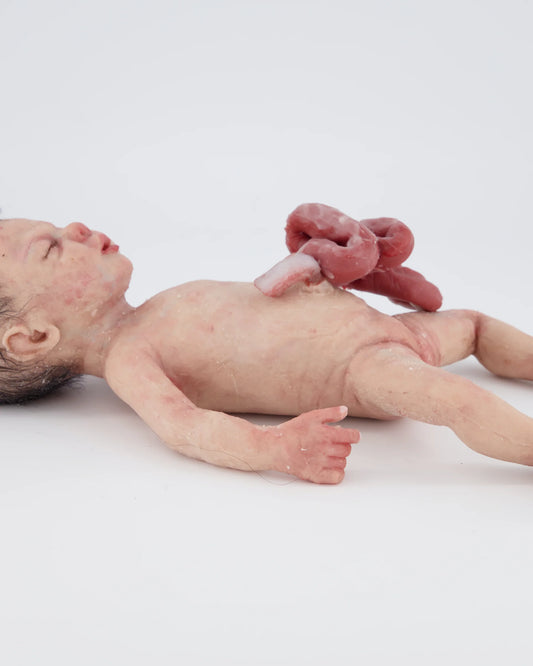 MO816 Baby Libby Gastrochisis 32 week baby birthing trainer image 1