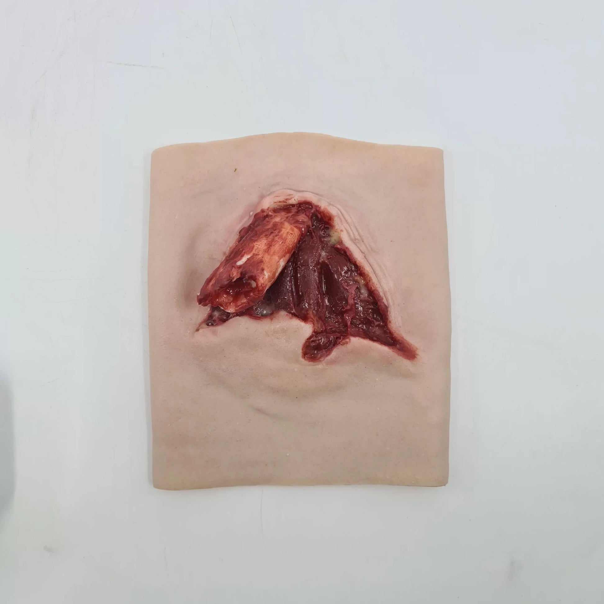 MT004 Broken Humerus Trauma image 0