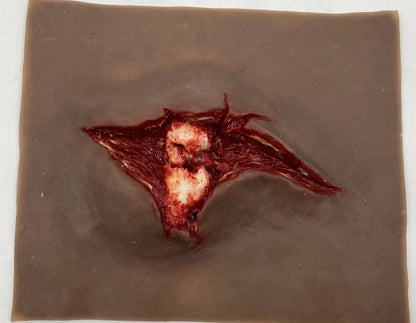 MT001 Open Fracture Trauma image 1