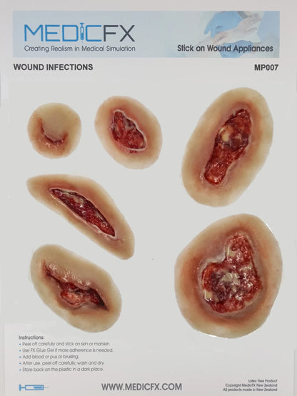 MP007 Sheet Wound Infections image 0