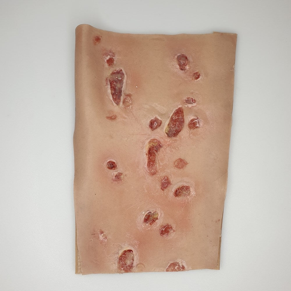 MW060 Diabetic Sores On Leg image 1