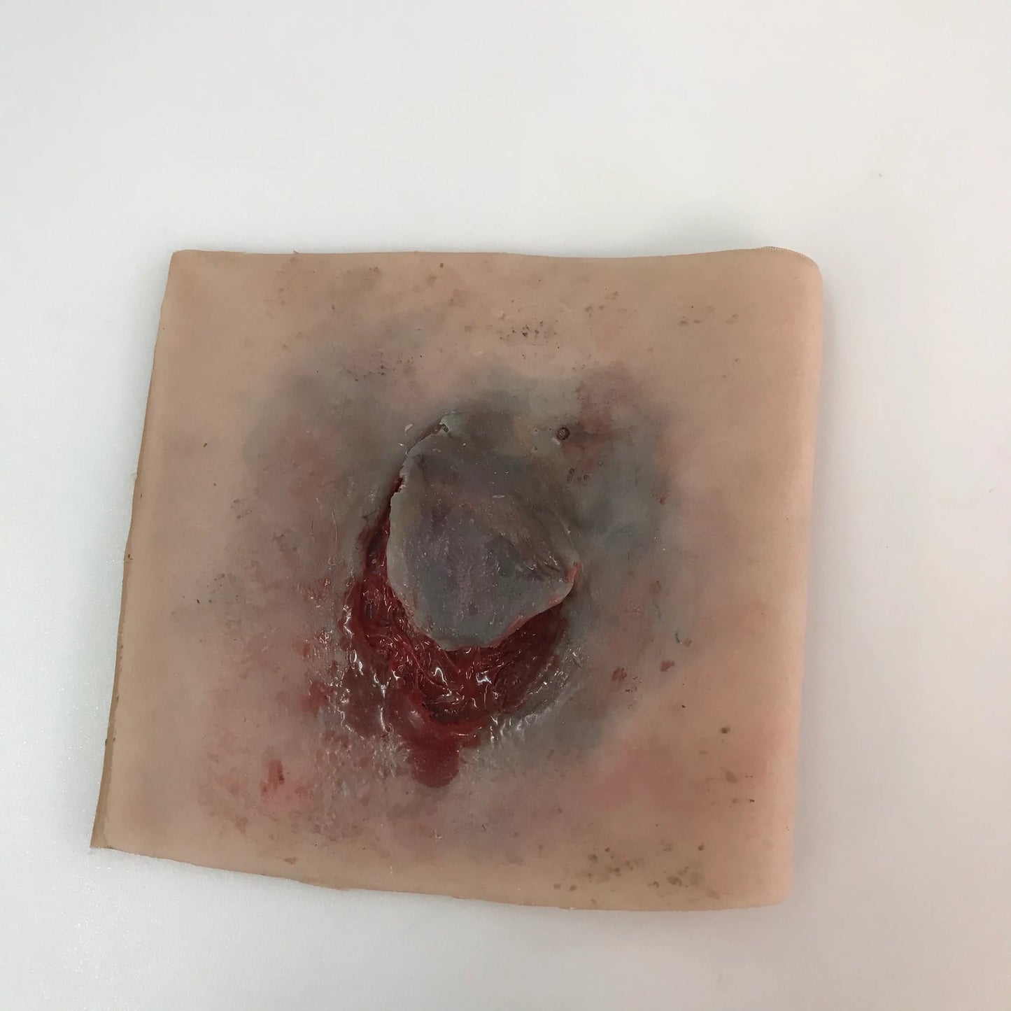 MT022 Elderly Skin Tear image 1