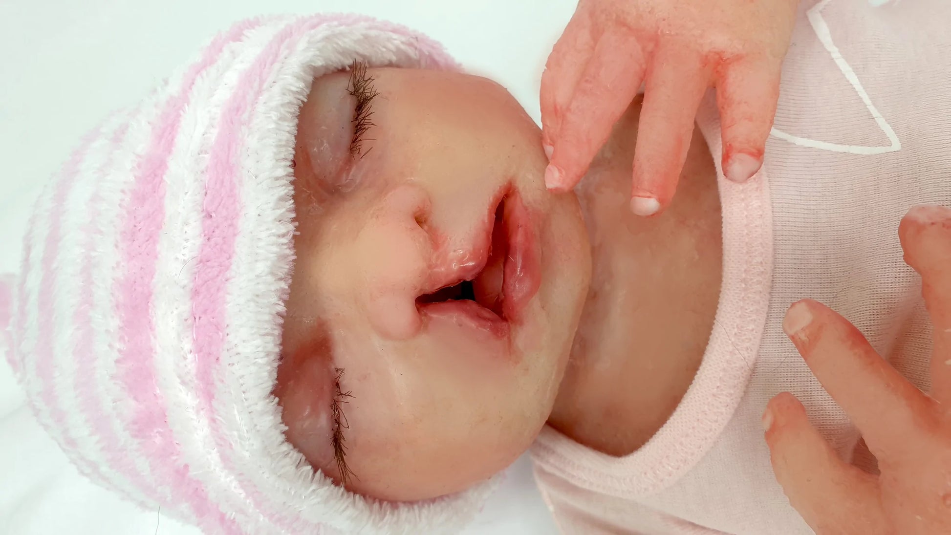 MO822 Baby Nina with cleft lip feeding trainer image 3