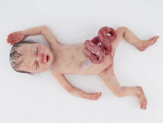 MO816 Baby Libby Gastrochisis 32 week baby birthing trainer image 0