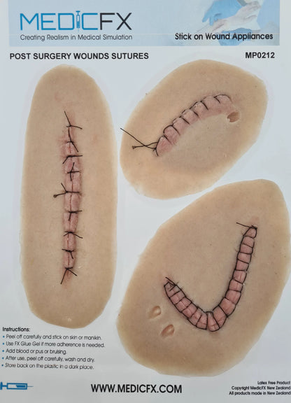 MP0212 Post Surgical Sutures image 0