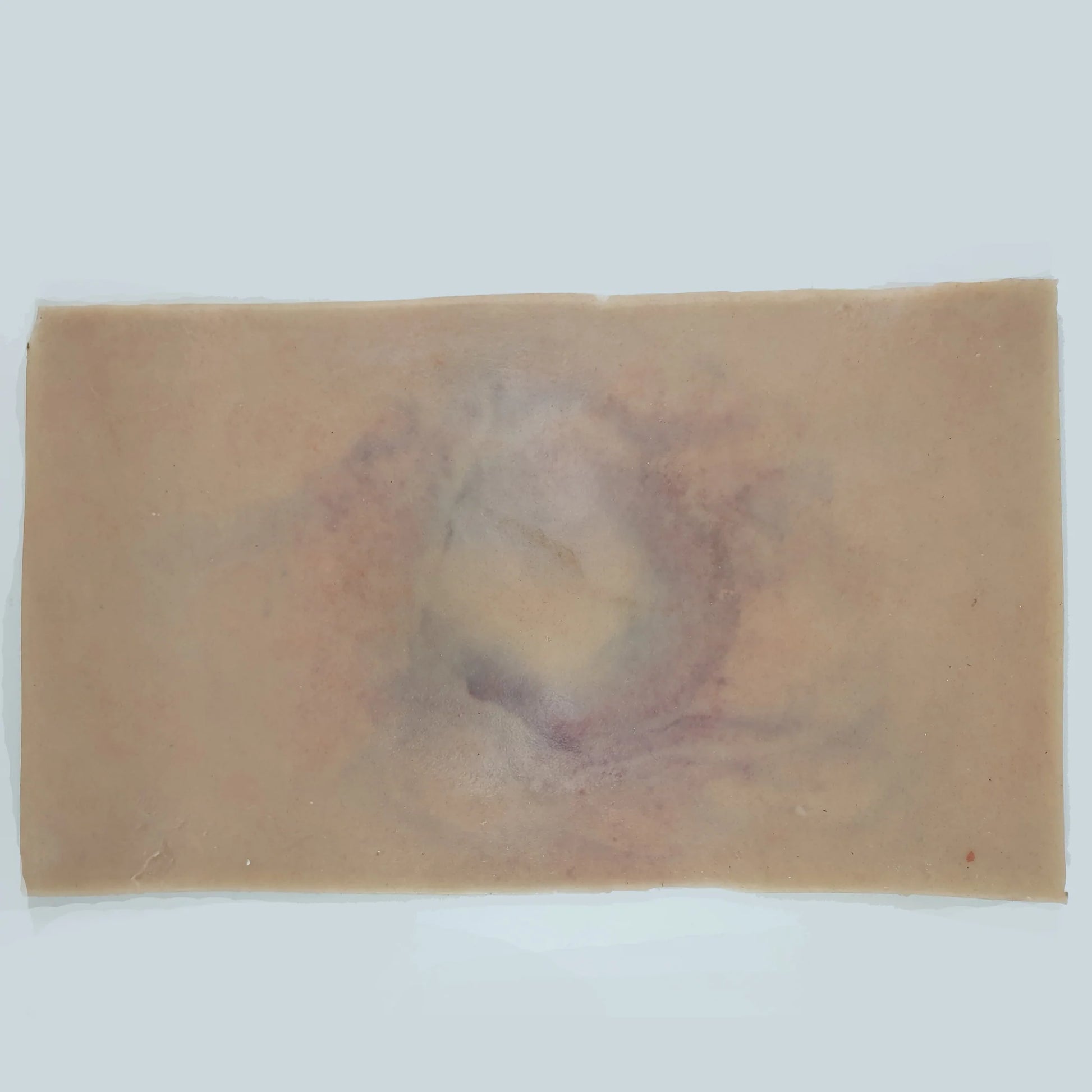 MT0031 Fracture Closed Small image 3