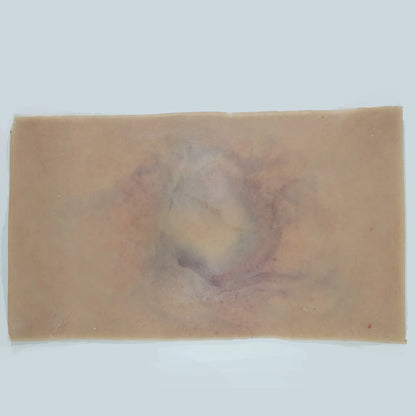 MT0031 Fracture Closed Small image 3