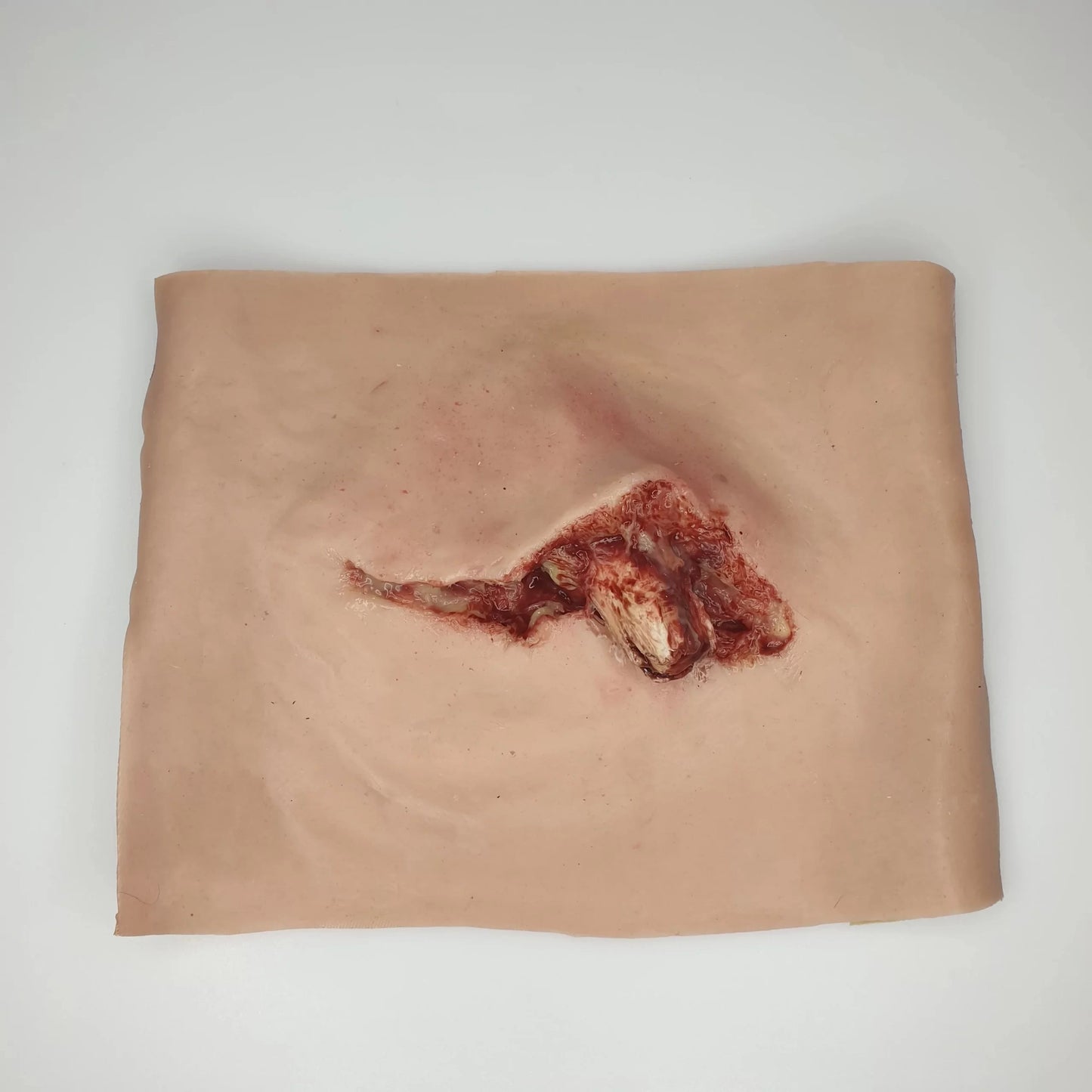 MT002 Protruding Femur Fracture image 3
