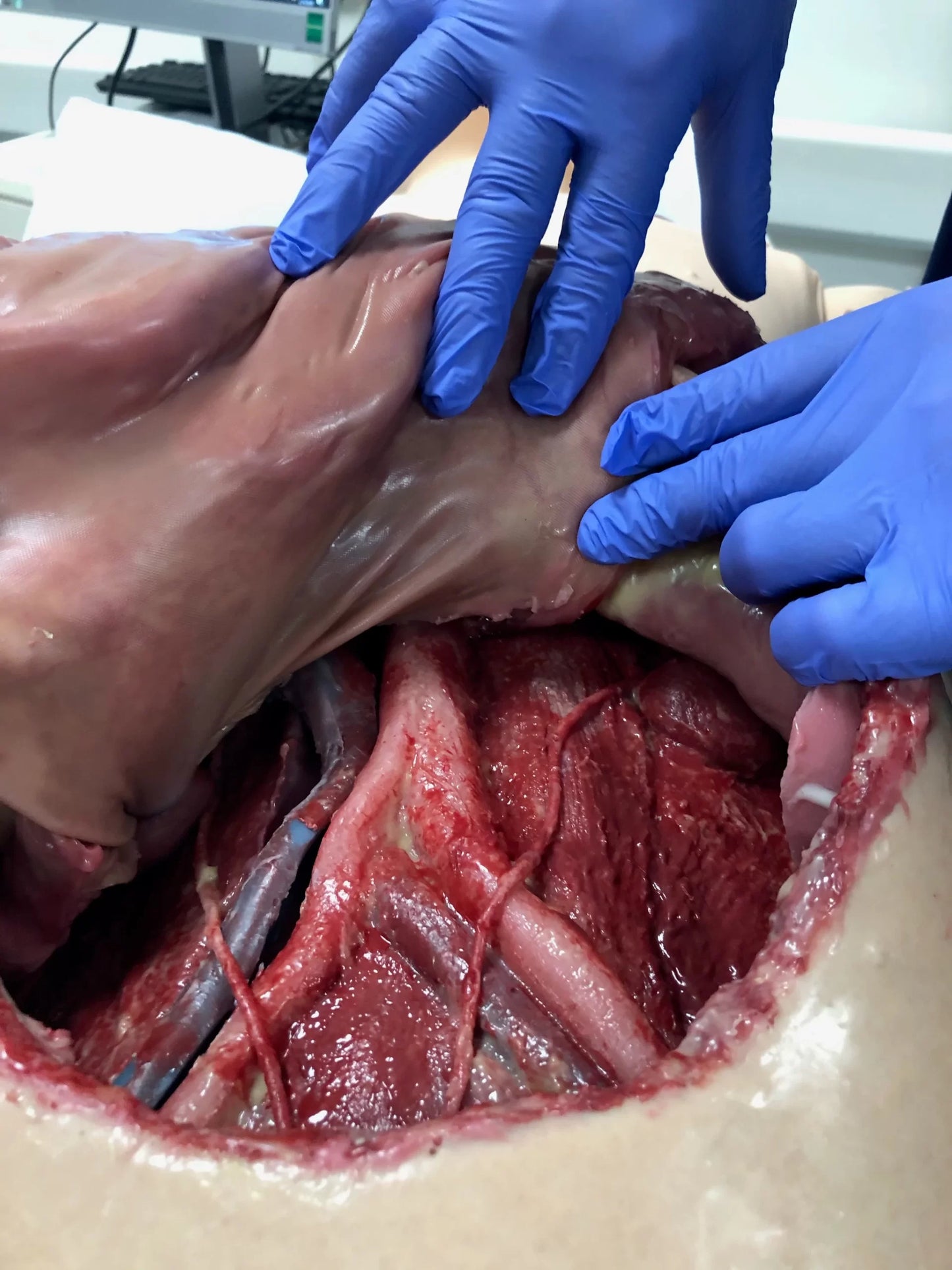 MSURG050 Abdominal Surgical Training Model Flexible image 2