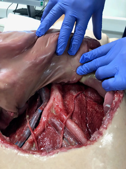 MSURG050 Abdominal Surgical Training Model Flexible image 2