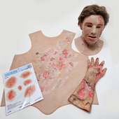 MB810-L-F Burns Patient