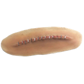MO950 Stick-on C- section wound with staples