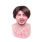 MM600 Eduardo Anaphylaxis SimMan Facial Overlay