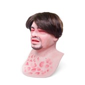 MM600 Eduardo Anaphylaxis SimMan Facial Overlay
