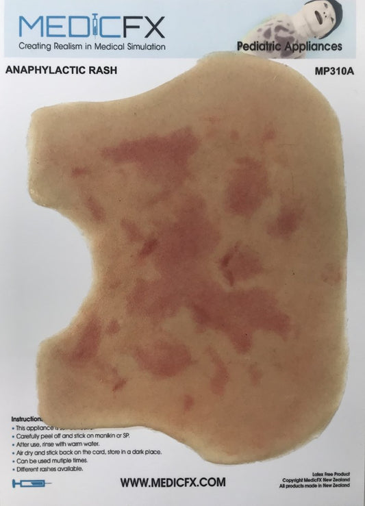 MP310 Anaphylaxis Rash Infant Chest