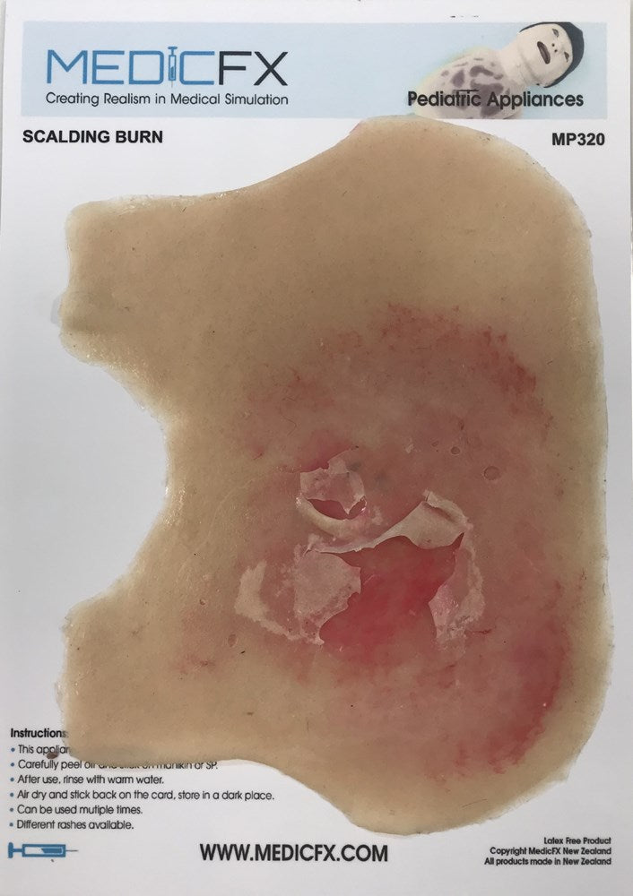 MP320 Scalding Burn Infant Chest