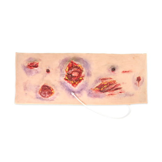 MS200 Multiple Abdominal Gun Shot Wounds (New)