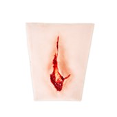 MT005 Open Wrist Fracture