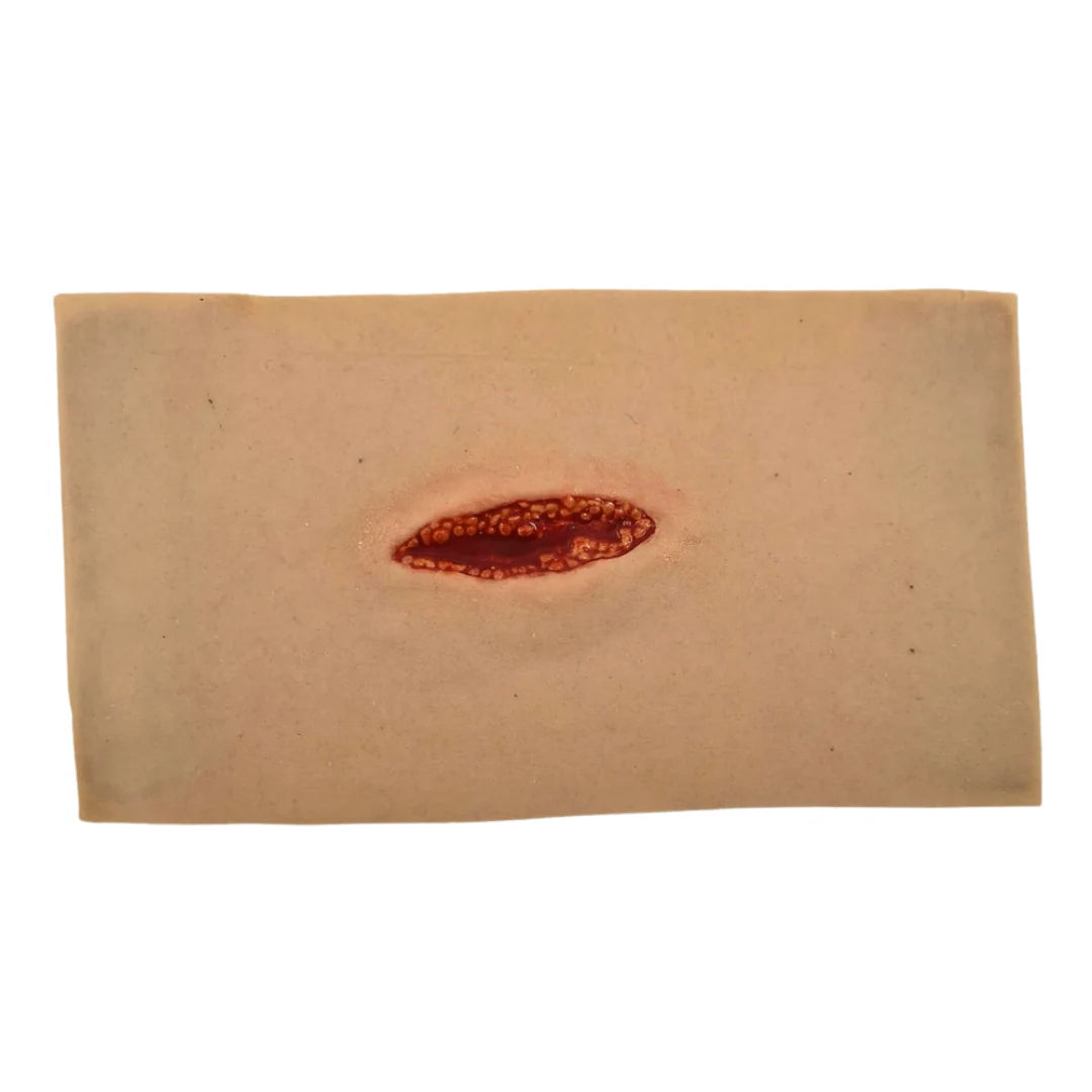 MT009 Small Laceration