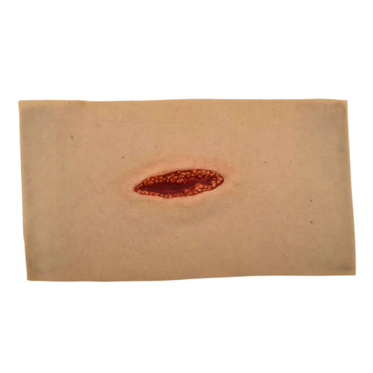 MT009 Small Laceration