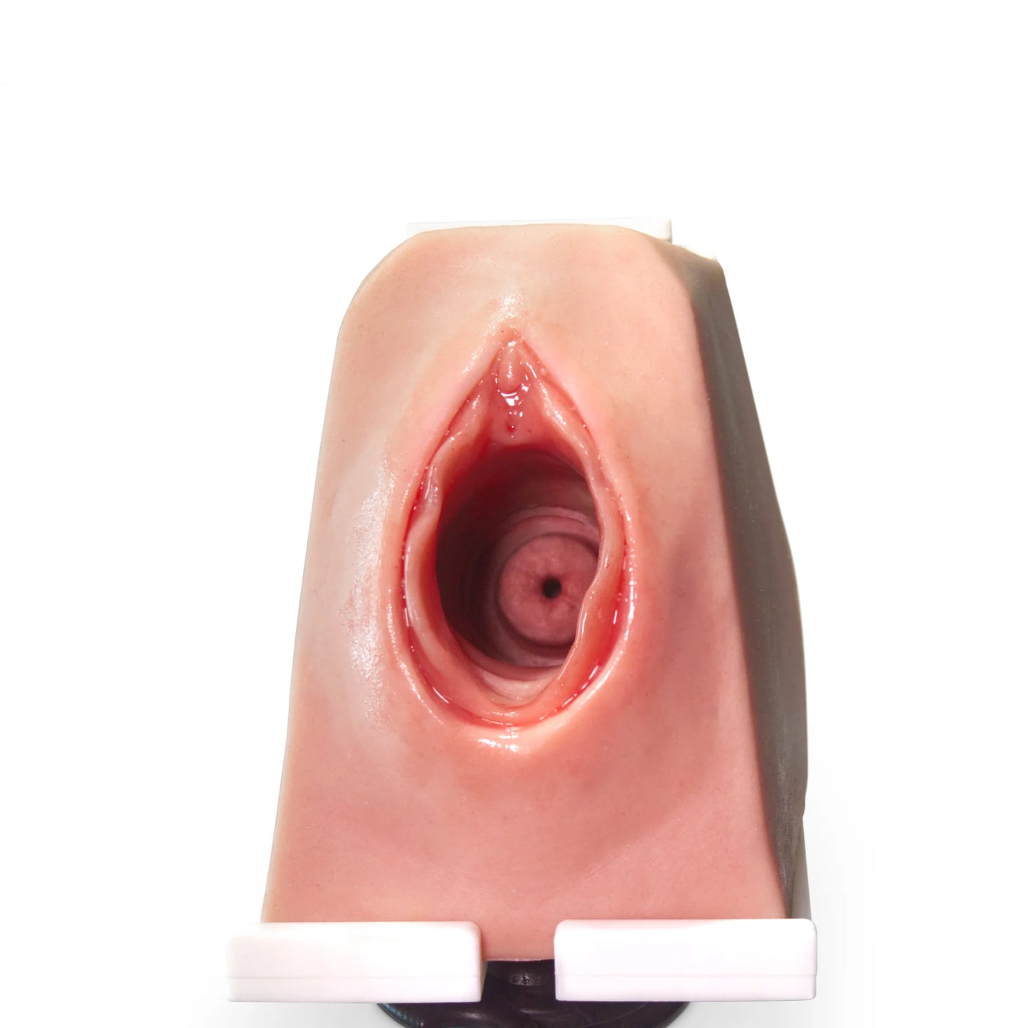 MW230 Cerclage Model