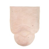MW240 Edema Leg
