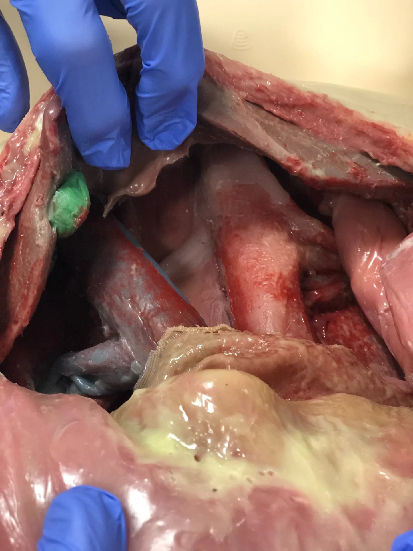 MSURG050 Abdominal Surgical Training Model Flexible image 4