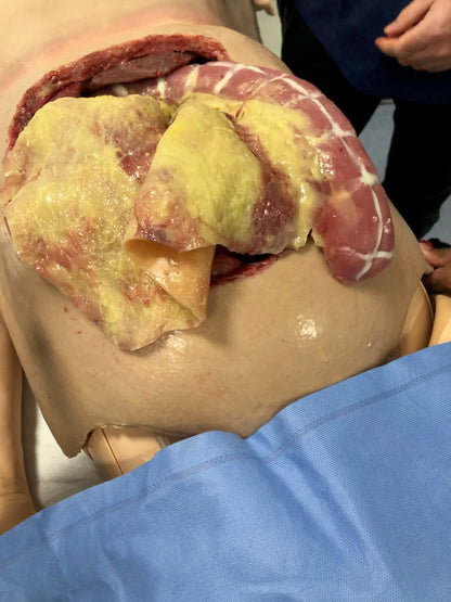 MSURG050 Abdominal Surgical Training Model Flexible image 1