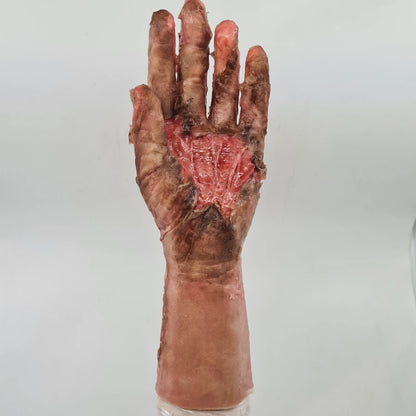 MB215 Burned Hand image 1