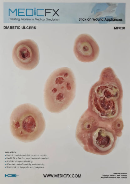 MP020 Sheet Diabetic Ulcers image 2