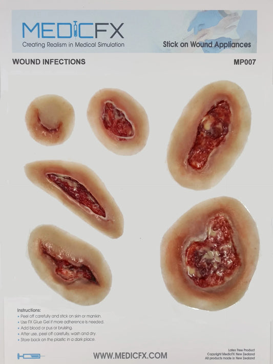 MP007 Sheet Wound Infections image 1
