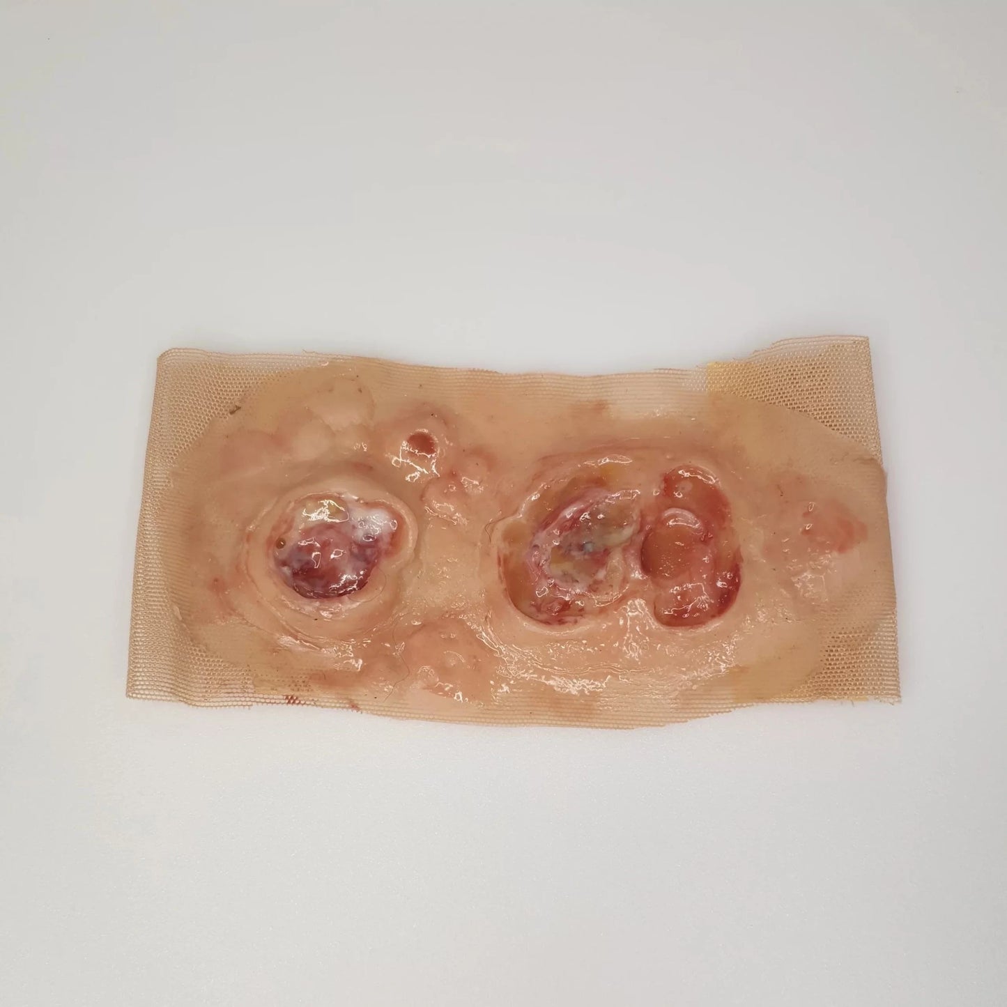 MW020 Wrap Around Ulcers image 0