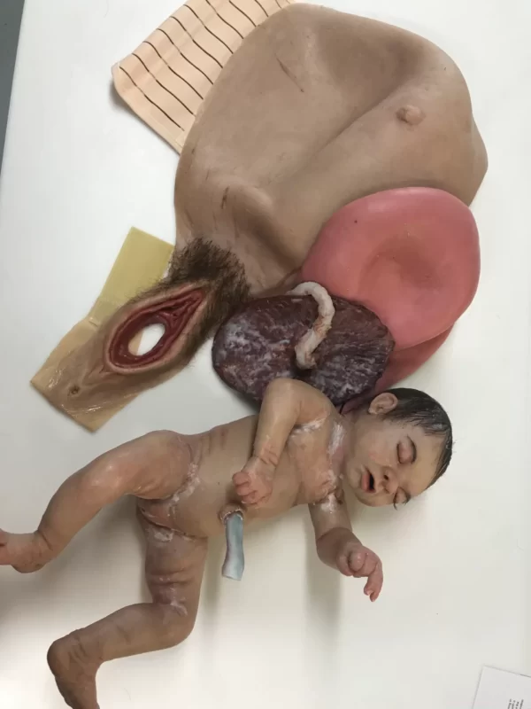 C Section birthing package