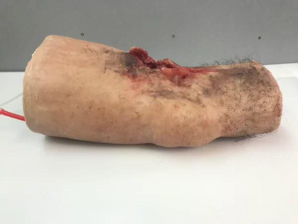 Trauma wound packing leg